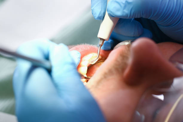 Best Emergency Cosmetic Dentistry (e.g., broken veneers) in Taft, TX